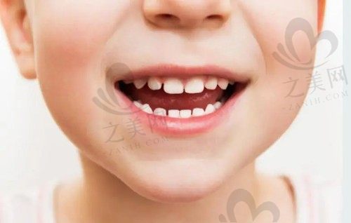 小孩矫正牙齿什么年龄合适?8岁孩子适合矫正牙齿吗?