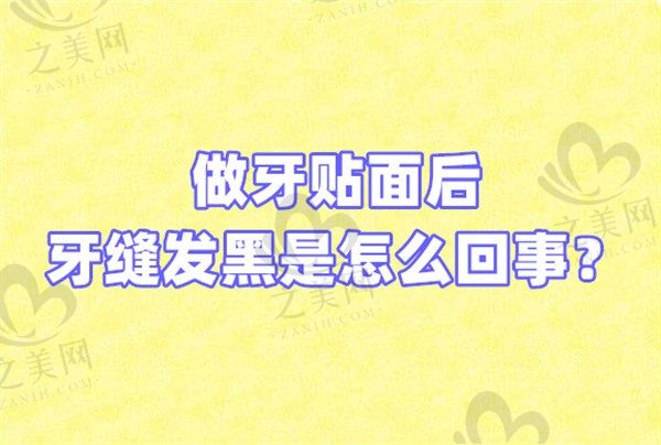 做牙贴面后牙缝发黑是怎么回事?需要做什么处理吗?