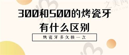 300和500元的烤瓷牙有啥区别?烤瓷牙一生能换几次?