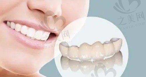 牙齿修复的几种方法和价格 做一个牙龈修复大概多少钱?
