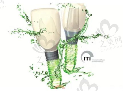 瑞士ITI种植牙亲水材料