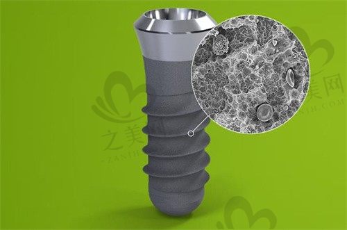士卓曼种植体亲水非亲水什么区别?iti种植体型号如何选择