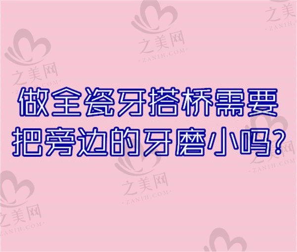 做全瓷牙搭桥需要把旁边的牙磨小吗?是不是会损伤牙根?