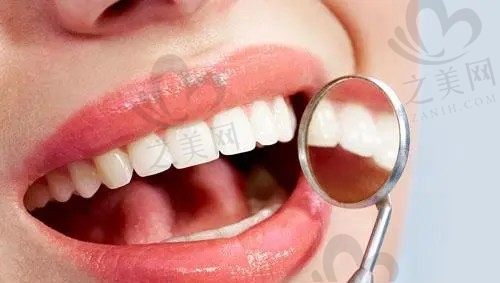 根尖炎可以不拆烤瓷牙吗? 解析烤瓷牙为什么会有根尖