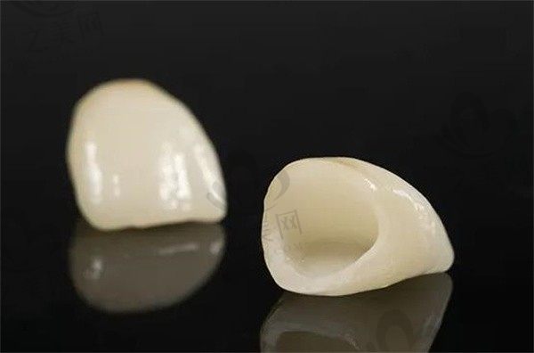 什么情况下不能做全瓷牙冠?不能做全瓷牙冠能去种牙吗?