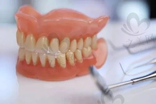 全口假牙有哪几种类型?全口假牙的种类和价格