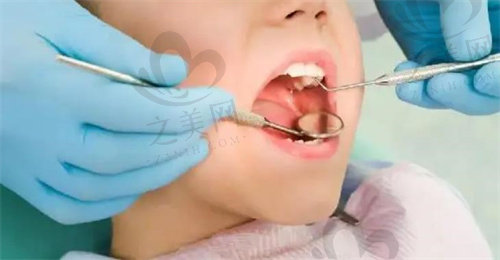 儿童牙齿定期涂氟和检查