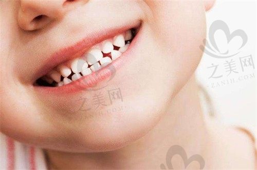 新手家长必看:宝宝多大可以涂氟刷牙?儿牙护理技能快来get