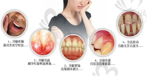 牙龈萎缩容易引起多种危害