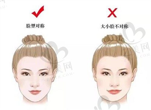长期用一侧吃饭脸歪怎么办?大小脸矫正需要带牙套还是做手术