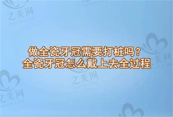 做全瓷牙冠需要打桩吗?揭秘全瓷牙冠怎么戴上去的全过程