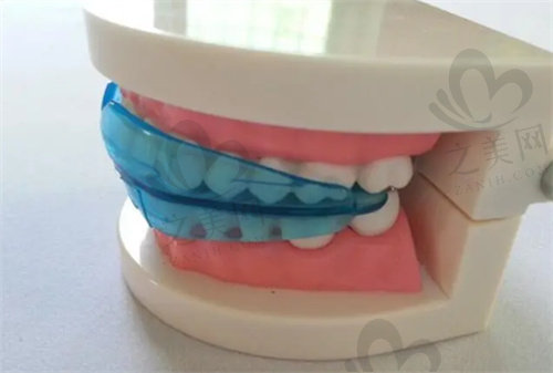 正规牙齿矫正需到医院进行检查后设计方案