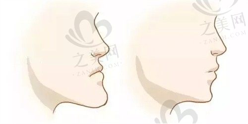 咬合左右高低不一样不对称怎么办?参考正常的上下牙咬合图片