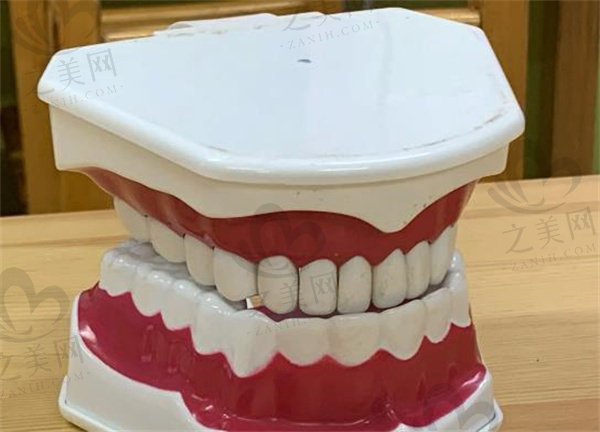 牙齿矫正模型