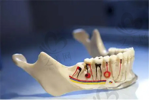 牙胶填充是根管治疗的收尾阶段