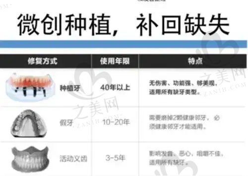 微创种植牙优点