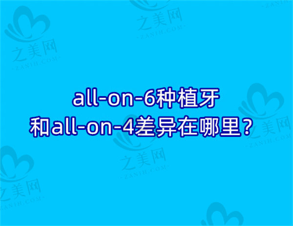 all-on-6种植牙和all-on-4差异在哪里？