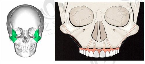 科学解答牙槽骨吸收还能种牙吗?种完的假牙根会不会脱落?