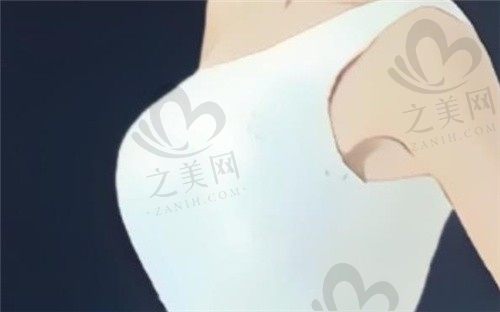 上海华美谢卫国隆胸怎么样?假体隆胸技术高+做过隆胸的反馈口碑好