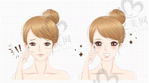 郑州缔莱美杨胜发割双眼皮怎么样，至臻生态美眼6000元起