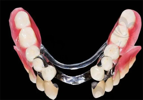 活动义齿影响牙槽骨吗