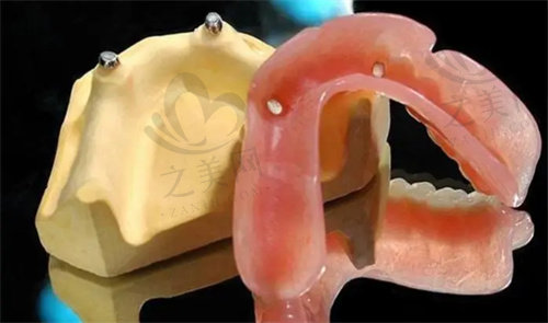 残留牙根与假牙基托上都需安装磁性材料