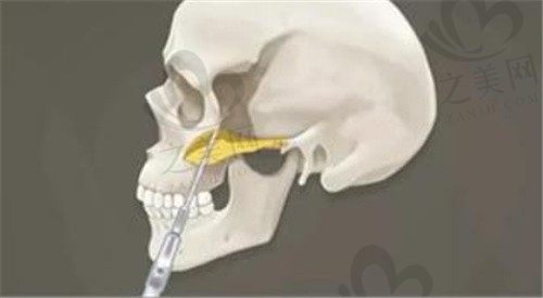 问上海何晋龙擅长哪些方面的整形?正颌技术好不好?磨骨怎么样?