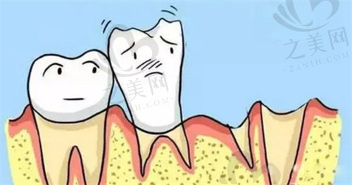 牙齿缺损仅剩牙根