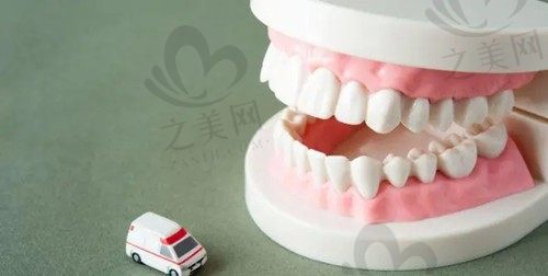 牙周炎适合种植牙吗?来看看什么人群不适合种植牙