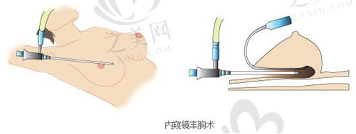 王洪医生技术怎么样？