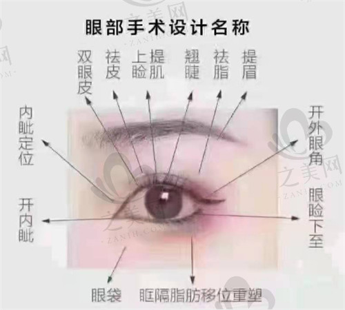 眼部手术涉及部位
