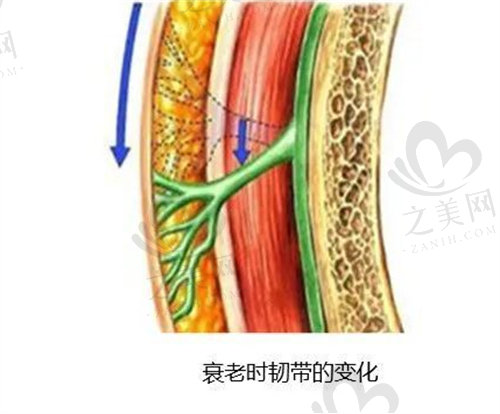 皮肤衰老韧带老化