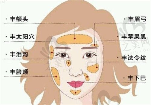 广州王世虎脂肪填充怎么样?听说做脂肪隆胸和全脸填充效果好