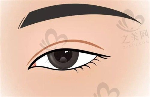 种植牙价格怎么样_之美网