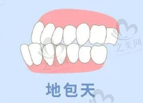 地包天整形手术后疼吗?十个问题全方位了解地包天手术矫正过程