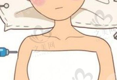 西安米兰柏羽宋新隆胸手术怎么样？内窥镜假体隆胸30000元起超值