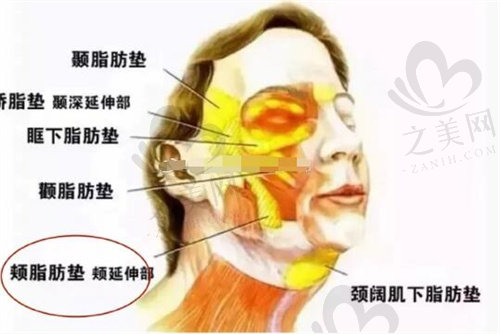 上海华东医院整形外科面部吸脂部位