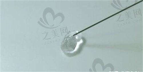 上海华东医院玻尿酸