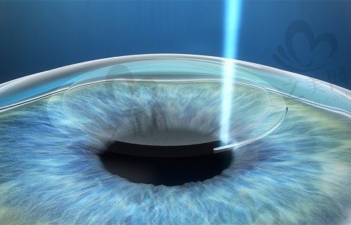 北京协和医院眼科预约挂号,不仅能预约挂号还可以查询医生技术