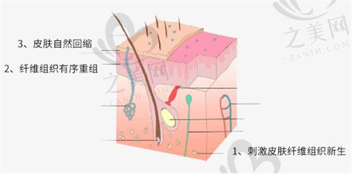 香港大学深圳医院整形外科吸脂