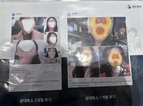 韩国脸本整形外科真人册子
