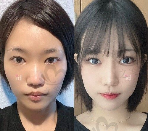 韩国ID整形医院怎么样?韩国排名前十,口碑评价好