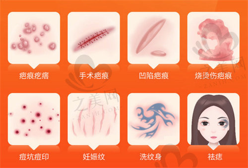 上海长征医院整形科祛疤怎么样