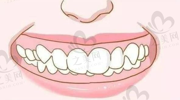 老年人还能做牙齿矫正吗?做了有效果或者存在风险吗