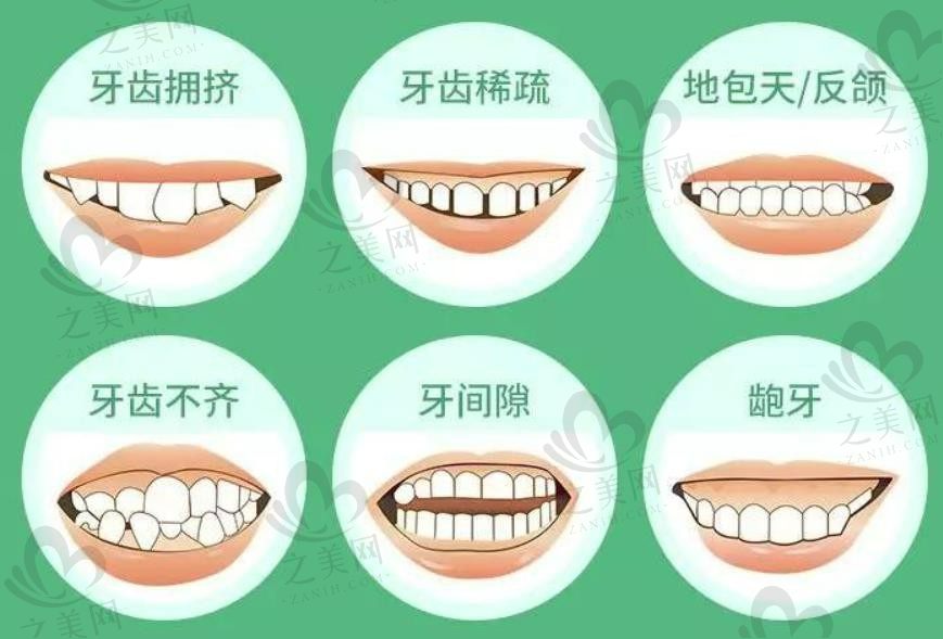 贵金属烤瓷牙是什么意思?价格对比普通的烤瓷牙贵吗
