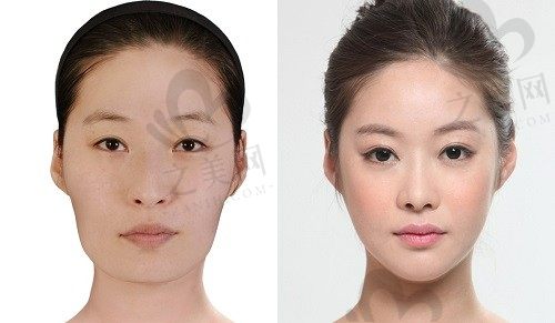 韩国BK整形外科怎么样?位置环境\评价口碑\特色项目\手术实例分享