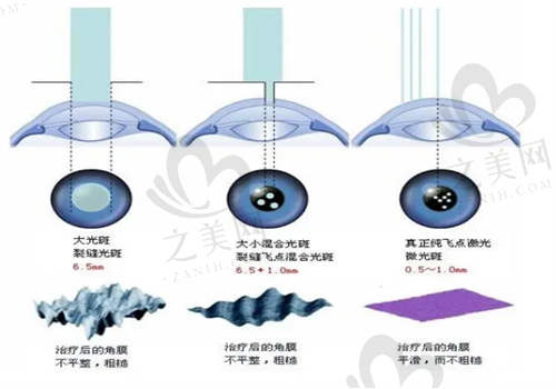 温州医科大学附属眼视光医院