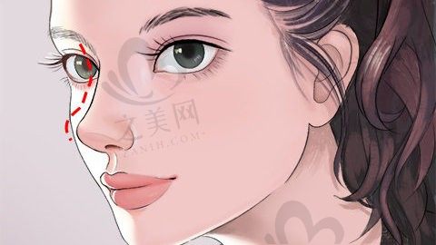 杭州眼部整形医院有哪些?介绍几家价格比较实惠的医院