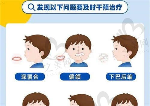 上海泰康拜博昌仁口腔医院正颌手术医生不错,可矫正骨性龅牙等牙颌畸形