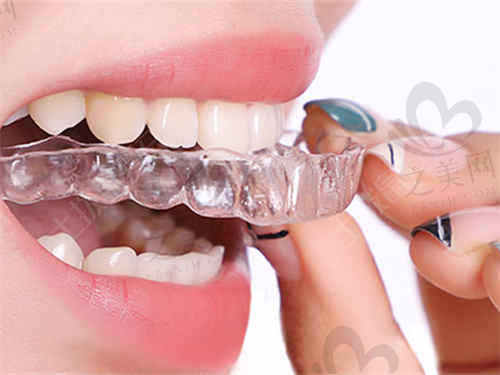 呼和浩特华医口腔医院牙齿矫正有哪些方式